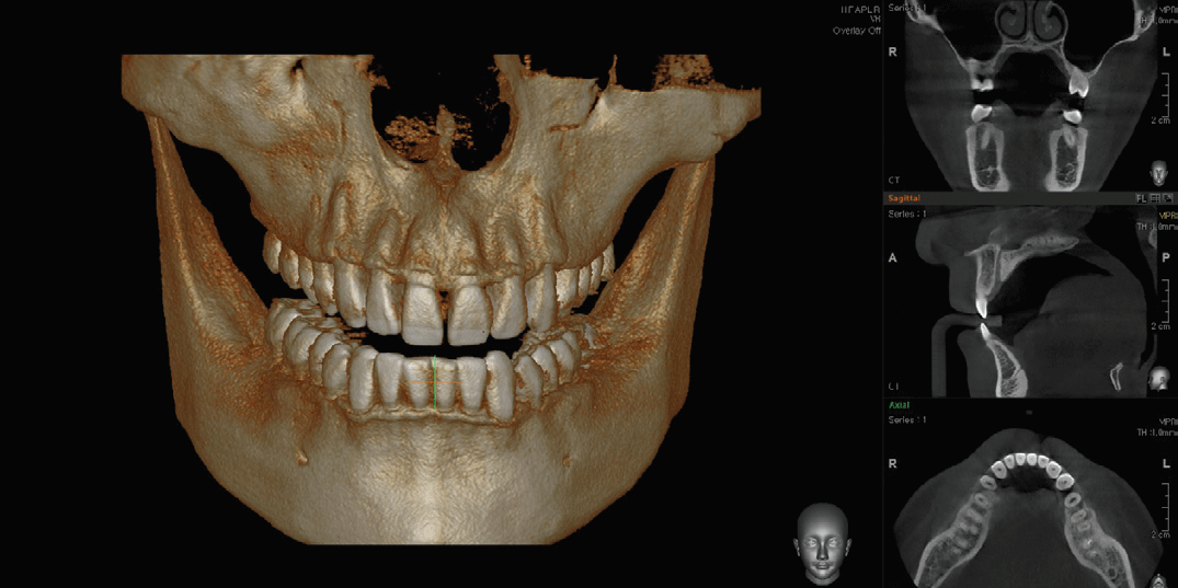 dental-cone-beam-ct-scan-burbank-my-dentist-burbank